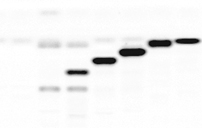 Click / Alkyne Lipids