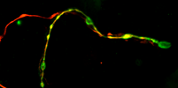 Neuronal degeneration /regeneration 