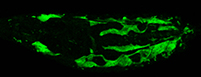 Lipid metabolism